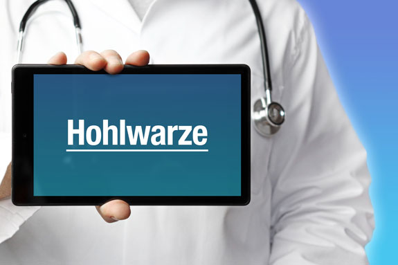Schlupfwarzen Limburg